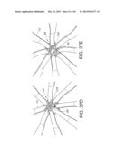 BASKET STYLE CARDIAC MAPPING CATHETER HAVING A FLEXIBLE ELECTRODE ASSEMBLY     FOR SENSING MONOPHASIC ACTION POTENTIALS diagram and image