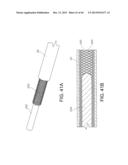 BASKET STYLE CARDIAC MAPPING CATHETER HAVING A FLEXIBLE ELECTRODE ASSEMBLY     FOR SENSING MONOPHASIC ACTION POTENTIALS diagram and image