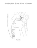 REGISTRATION DEVICE, SYSTEM, KIT AND METHOD FOR A PATIENT REGISTRATION diagram and image