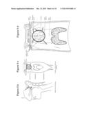 REGISTRATION DEVICE, SYSTEM, KIT AND METHOD FOR A PATIENT REGISTRATION diagram and image