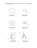 REGISTRATION DEVICE, SYSTEM, KIT AND METHOD FOR A PATIENT REGISTRATION diagram and image