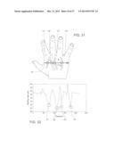 System for Locating a Transcutaneous Sensor on Skin diagram and image