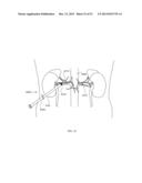 ENERGETIC MODULATION OF NERVES diagram and image