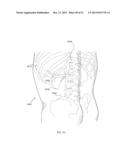 ENERGETIC MODULATION OF NERVES diagram and image