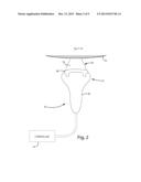 ULTRASONIC HEAD TRAP diagram and image