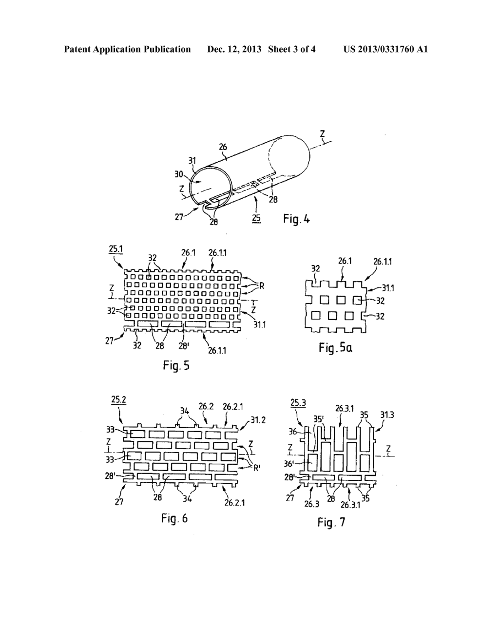 IMPLANT FOR THE TREATMENT OF GLAUCOMA - diagram, schematic, and image 04