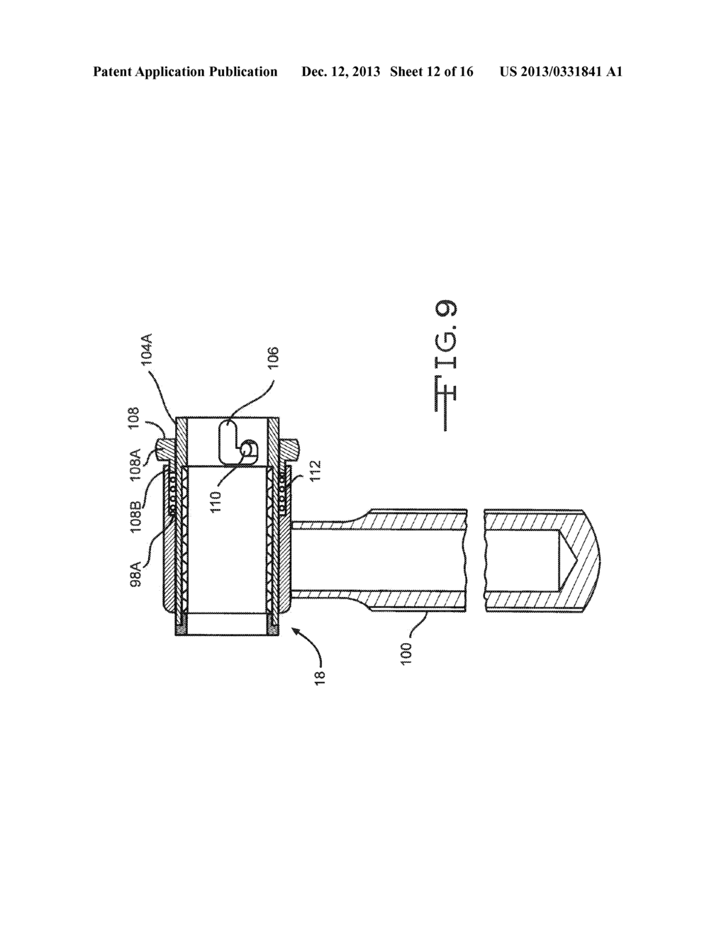 ANGLED REAMER SPINDLE FOR MINIMALLY INVASIVE HIP REPLACEMENT SURGERY - diagram, schematic, and image 13