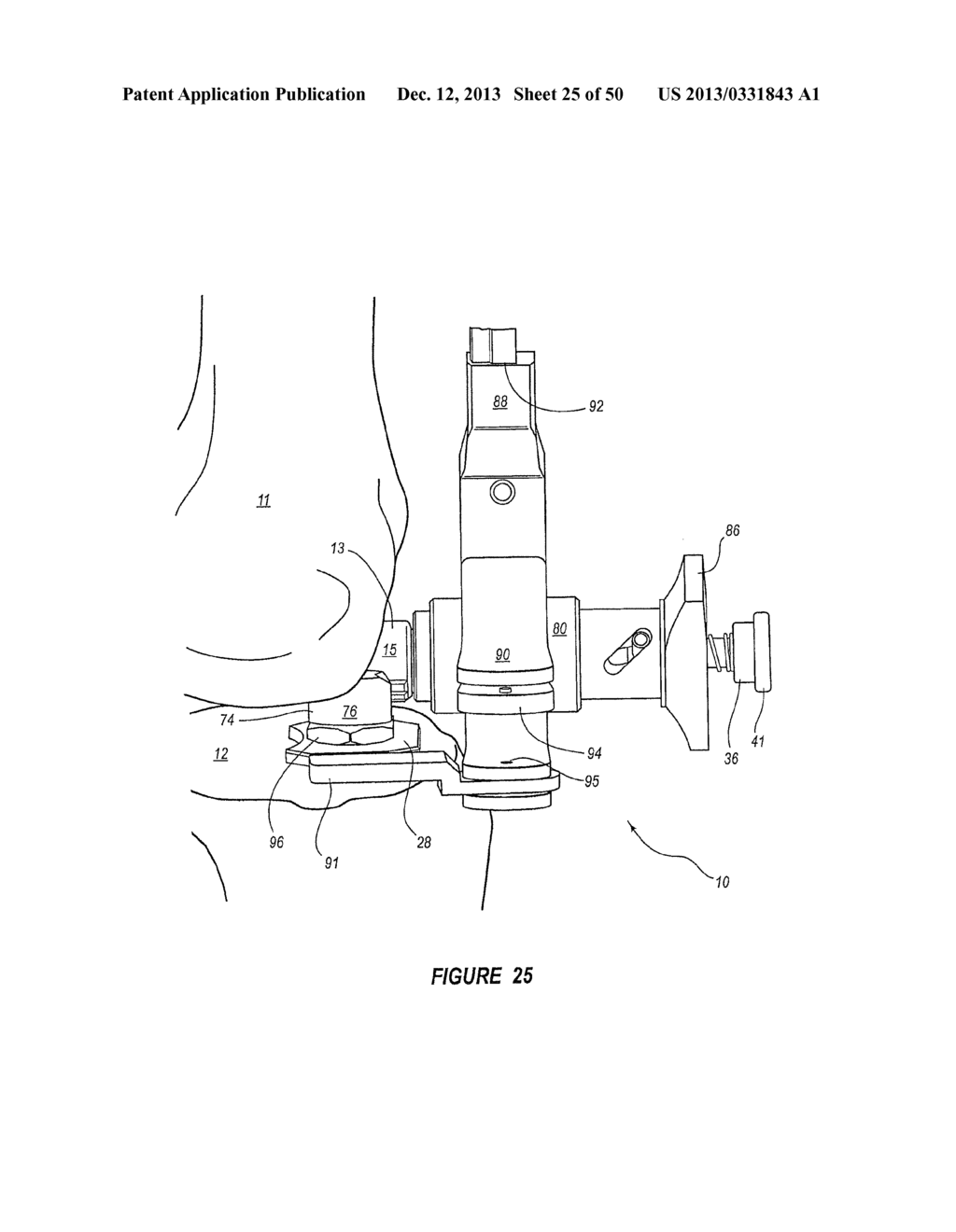 ARTHROPLASTY SYSTEMS AND METHODS FOR OPTIMALLY ALIGNING AND TENSIONING A     KNEE PROSTHESIS - diagram, schematic, and image 26