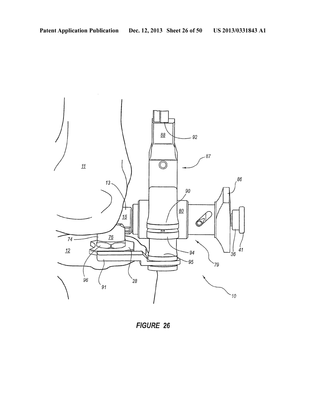 ARTHROPLASTY SYSTEMS AND METHODS FOR OPTIMALLY ALIGNING AND TENSIONING A     KNEE PROSTHESIS - diagram, schematic, and image 27