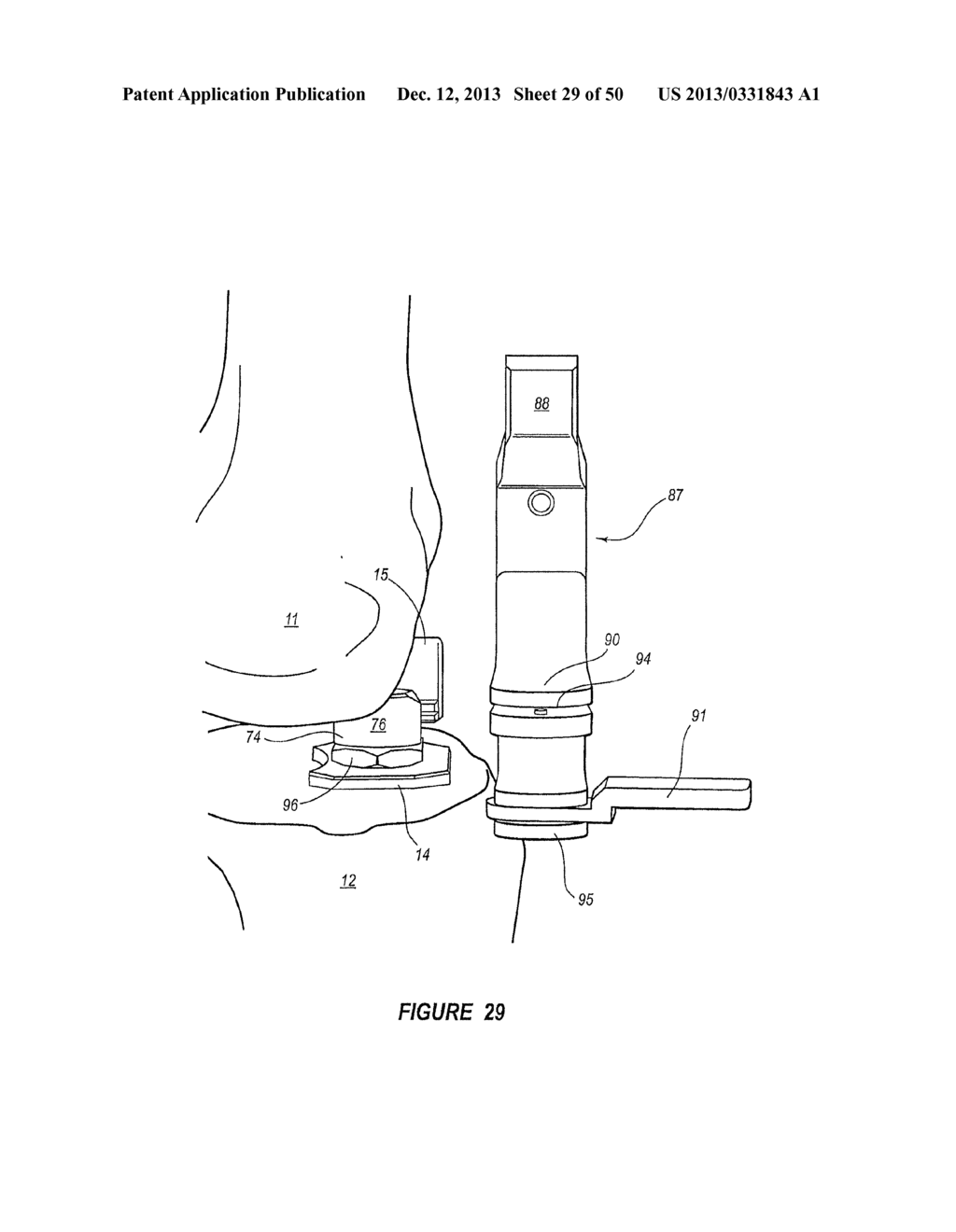 ARTHROPLASTY SYSTEMS AND METHODS FOR OPTIMALLY ALIGNING AND TENSIONING A     KNEE PROSTHESIS - diagram, schematic, and image 30