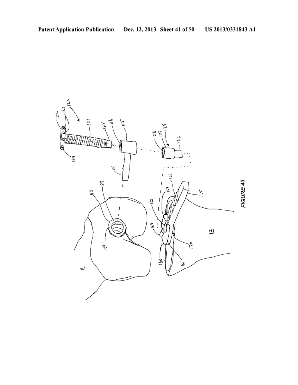 ARTHROPLASTY SYSTEMS AND METHODS FOR OPTIMALLY ALIGNING AND TENSIONING A     KNEE PROSTHESIS - diagram, schematic, and image 42