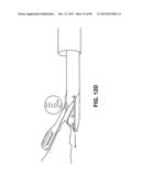 SUTURE PASSER DEVICES AND METHODS diagram and image