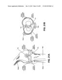 SUTURE PASSER DEVICES AND METHODS diagram and image