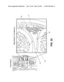 SUTURE PASSER DEVICES AND METHODS diagram and image