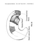 SUTURE PASSER DEVICES AND METHODS diagram and image