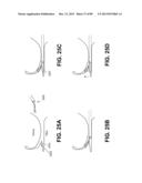 SUTURE PASSER DEVICES AND METHODS diagram and image