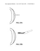 SUTURE PASSER DEVICES AND METHODS diagram and image