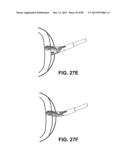 SUTURE PASSER DEVICES AND METHODS diagram and image