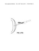 SUTURE PASSER DEVICES AND METHODS diagram and image