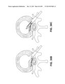 SUTURE PASSER DEVICES AND METHODS diagram and image