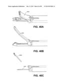 SUTURE PASSER DEVICES AND METHODS diagram and image