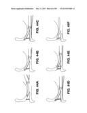 SUTURE PASSER DEVICES AND METHODS diagram and image