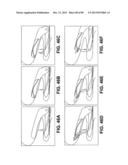 SUTURE PASSER DEVICES AND METHODS diagram and image