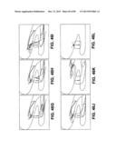 SUTURE PASSER DEVICES AND METHODS diagram and image