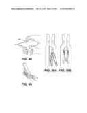 SUTURE PASSER DEVICES AND METHODS diagram and image