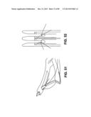 SUTURE PASSER DEVICES AND METHODS diagram and image