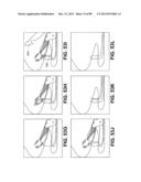 SUTURE PASSER DEVICES AND METHODS diagram and image