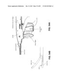 SUTURE PASSER DEVICES AND METHODS diagram and image