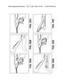 SUTURE PASSER DEVICES AND METHODS diagram and image