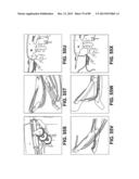 SUTURE PASSER DEVICES AND METHODS diagram and image