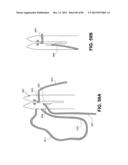 SUTURE PASSER DEVICES AND METHODS diagram and image