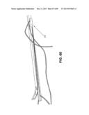 SUTURE PASSER DEVICES AND METHODS diagram and image