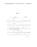 Methods and Apparatus to Stimulate Heart Atria diagram and image