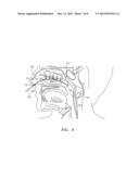 DEVICES FOR COOLING THE NASAL CAVITY diagram and image