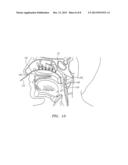 DEVICES FOR COOLING THE NASAL CAVITY diagram and image