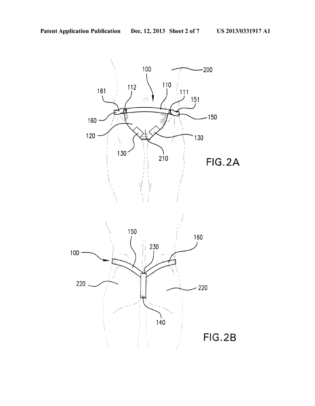 METHODS AND APPARATI FOR THE CLOSE APPLICATION OF THERAPEUTIC AND OTHER     DEVICES TO THE PELVIC AREA - diagram, schematic, and image 03