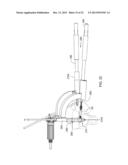 UPPER EXTREMITY FUSION DEVICES AND METHODS diagram and image