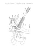 UPPER EXTREMITY FUSION DEVICES AND METHODS diagram and image