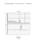 SYSTEMS AND METHODS FOR VIDEO CAPTURE, USER FEEDBACK, REPORTING, ADAPTIVE     PARAMETERS, AND REMOTE DATA ACCESS IN VEHICLE SAFETY MONITORING diagram and image