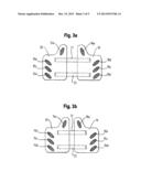 Back or Pelvic Belt diagram and image