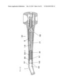 Mouthpiece diagram and image