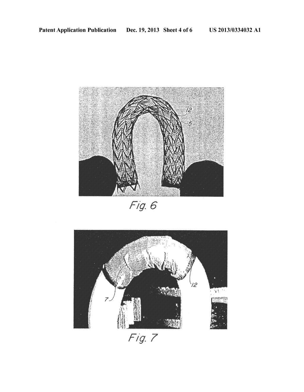 COMPLIANT IMPLANTABLE MEDICAL DEVICES AND METHODS OF MAKING SAME - diagram, schematic, and image 05