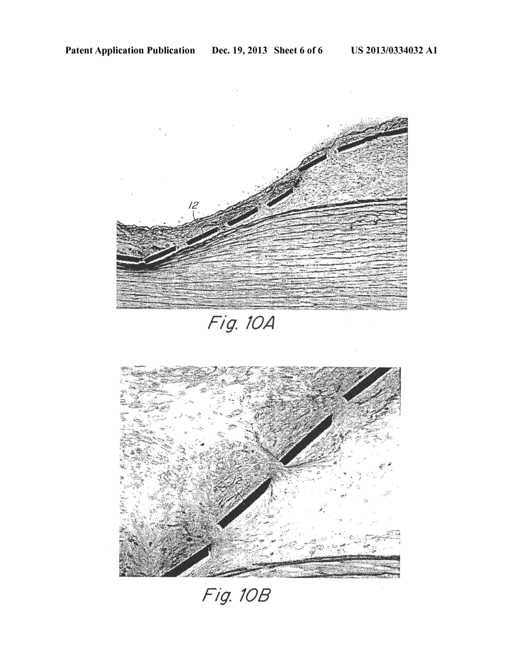COMPLIANT IMPLANTABLE MEDICAL DEVICES AND METHODS OF MAKING SAME - diagram, schematic, and image 07