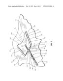 AIRBAG WITH ACTIVE VENT diagram and image