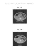 ADAPTIVELY DETERMINED PARAMETER VALUES IN ITERATIVE RECONSTRUCTION METHOD     AND SYSTEM diagram and image