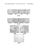 TUMOR SPECIFIC ANTIBODIES AND USES THEREFOR diagram and image